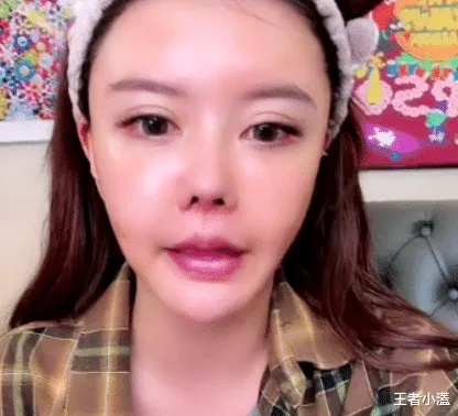 韩安冉抽脂术后留下七八个疤点，揭秘网红整形背后的风险与代价