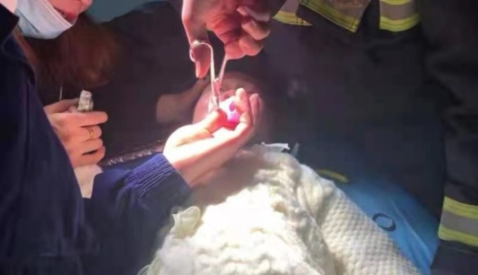 紧急救援！女生手卡在男生嘴里拔不出，医院紧急出动