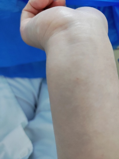 输液过敏离世女生曾要求皮试被拒，一场本可避免的悲剧